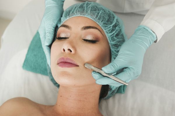 Coût et résultats de l'épilation laser du visage à considérer